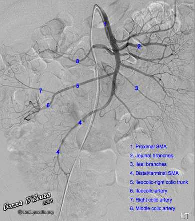 Contrast Media & Adverse Reactions