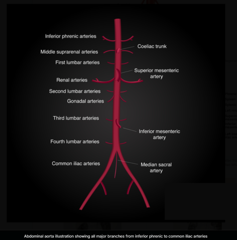 Aortoiliac Anatomy & Variants